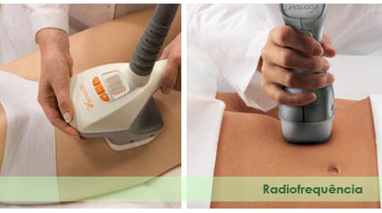 radiofrequencia corporal leblon e ipanema